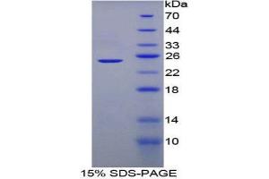 SDS-PAGE (SDS) image for Adenylate Cyclase 6 (ADCY6) (AA 314-501) protein (His tag) (ABIN2123938)