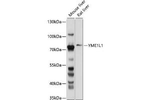 Western blot analysis of extracts of various cell lines, using YME1L1 antibody (ABIN6133153, ABIN6150333, ABIN6150334 and ABIN6214648) at 1:1000 dilution. (YME1L1 anticorps  (AA 1-240))