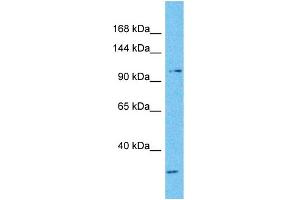 Host:  Rabbit  Target Name:  NFATC3  Sample Type:  Fetal Lung lysates  Antibody Dilution:  1.