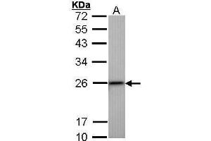 WB Image Sample (30 ug of whole cell lysate) A: Hep G2 , 12% SDS PAGE antibody diluted at 1:1000 (Transgelin anticorps)