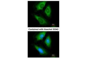ICC/IF Image Immunofluorescence analysis of paraformaldehyde-fixed HeLa, using HPRT, antibody at 1:200 dilution. (HPRT1 anticorps)
