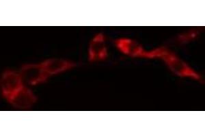 ABIN6274076 staining HeLa cells by IF/ICC.