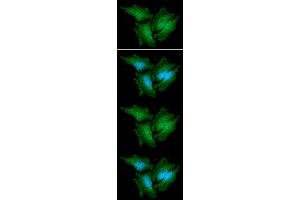 ICC/IF analysis of CTBP1 in A549 cells line, stained with DAPI (Blue) for nucleus staining and monoclonal anti-human CTBP1 antibody (1:100) with goat anti-mouse IgG-Alexa fluor 488 conjugate (Green) ICC/IF analysis of CTBP1 in HeLa cells line, stained with DAPI (Blue) for nucleus staining and monoclonal anti-human CTBP1 antibody (1:100) with goat anti-mouse IgG-Alexa fluor 488 conjugate (Green).