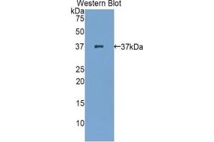 Detection of Recombinant zAP70, Mouse using Polyclonal Antibody to Zeta Chain Associated Protein Kinase 70 kDa (zAP70)