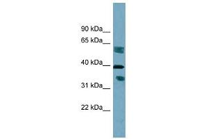 DHRS7B antibody used at 1 ug/ml to detect target protein. (DHRS7B anticorps)