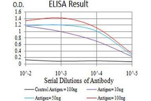 Fig. (TTF1 anticorps  (AA 1-150))