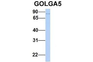 Host:  Rabbit  Target Name:  GOLGA5  Sample Type:  Human 293T  Antibody Dilution:  1. (GOLGA5 anticorps  (N-Term))