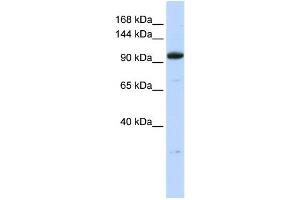 WB Suggested Anti-ZNF228 Antibody Titration:  0. (ZFP112 anticorps  (N-Term))