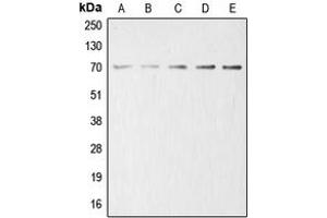 Western blot analysis of Acetylcholinesterase expression in HeLa (A), HEK293T (B), mouse liver (C), rat kidney (D), PC12 (E) whole cell lysates. (Acetylcholinesterase anticorps  (Center))