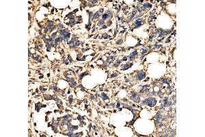 IHC analysis of SRP72 using anti-SRP72 antibody (ABIN7601648).