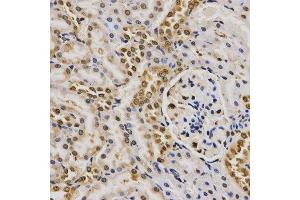 Immunohistochemistry of paraffin-embedded rat kidney tissue using H4R3me2a antibody at dilution of 1:200 (x400 lens)