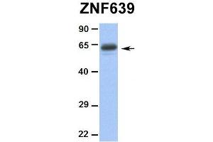 Hum. (ZNF639 anticorps  (N-Term))
