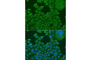 Immunofluorescence analysis of U2OS cells using FXR1 antibody.