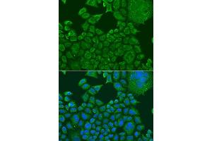Immunofluorescence analysis of U2OS cells using FXR1 antibody. (FXR1 anticorps  (AA 250-350))
