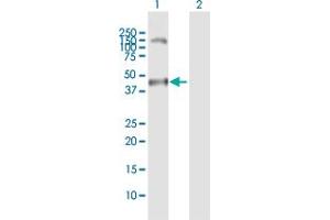 Western Blot analysis of MAGEA11 expression in transfected 293T cell line by MAGEA11 MaxPab polyclonal antibody. (MAGEA11 anticorps  (AA 1-319))