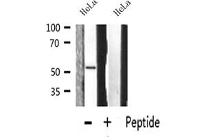 Western blot analysis on HeLa cell lysate using MMP-13 Antibody
