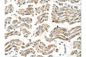 Immunohistochemistry (IHC) image for anti-Aldehyde Dehydrogenase 4 Family, Member A1 (ALDH4A1) (C-Term) antibody (ABIN2782324)