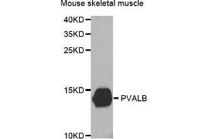 Western Blotting (WB) image for anti-Parvalbumin (PVALB) antibody (ABIN3016701) (PVALB anticorps)