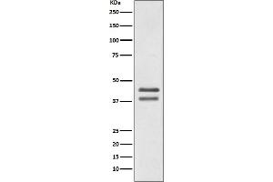 Western blot analysis of JunD expression in Jurkat cell lysate.