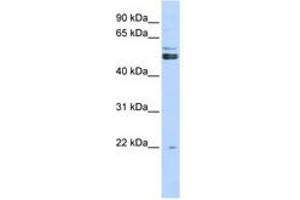 Image no. 1 for anti-Protein Arginine Methyltransferase 2 (PRMT2) (AA 71-120) antibody (ABIN6742957) (PRMT2 anticorps  (AA 71-120))