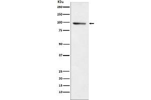 Western blot analysis of PDE4B expression in A549 cell lysate.