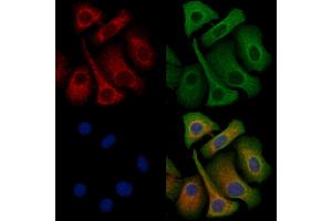 ABIN6263353 and ABIN6272349 staining Hela cells by IF/ICC. (Mrgprf anticorps  (C-Term))