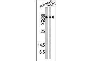 Image no. 1 for anti-V-Akt Murine Thymoma Viral Oncogene Homolog 1 (AKT1) (pTyr326) antibody (ABIN358076)