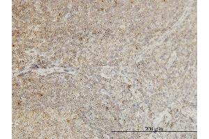 anti-Cyclin-Dependent Kinase-Like 4 (CDKL4) (AA 196-295) antibody