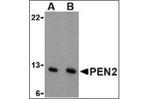 Western blot analysis of PEN2 in A-20 cell lysate with this product at (A) 0. (PEN2 anticorps  (N-Term))
