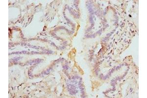 Immunohistochemistry of paraffin-embedded human lung tissue using ABIN7152931 at dilution of 1:100