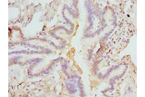 Immunohistochemistry of paraffin-embedded human lung tissue using ABIN7152931 at dilution of 1:100 (FCN1 anticorps  (AA 30-326))