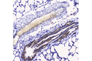 IHC analysis of Betacellulin using anti-Betacellulin antibody .