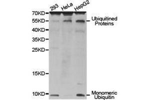 Western Blotting (WB) image for anti-Ubiquitin B (UBB) antibody (ABIN1875247) (Ubiquitin B anticorps)