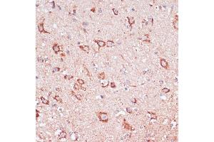 Immunohistochemistry of paraffin-embedded mouse spinal cord using ENTPD6 antibody (ABIN7266897) at dilution of 1:100 (40x lens).