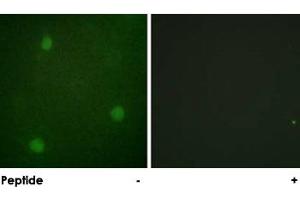 Immunofluorescence analysis of NIH/3T3 cells, using DCLRE1C polyclonal antibody . (DCLRE1C anticorps)