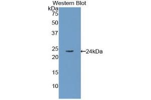 Western blot analysis of the recombinant protein. (RBP4 anticorps  (AA 18-201))