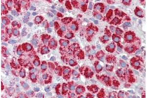 Human Adrenal (formalin-fixed, paraffin-embedded) stained with HSPD1 antibody ABIN462365 followed by biotinylated anti-goat IgG secondary antibody ABIN481715, alkaline phosphatase-streptavidin and chromogen.