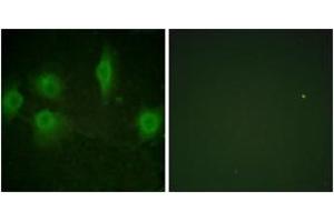 Immunofluorescence analysis of HuvEc cells, using IL-9R (Phospho-Ser519) Antibody. (IL9 Receptor anticorps  (pSer519))