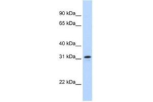 WB Suggested Anti-MKI67IP Antibody Titration:  0.