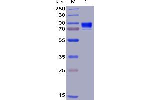 Human CD123, hFc-His Tag on SDS-PAGE under reducing condition.