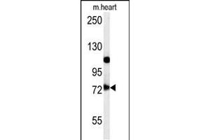 Western blot analysis in mouse heart tissue lysates (15ug/lane). (USP49 anticorps  (N-Term))
