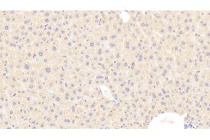 Detection of C1INH in Mouse Liver Tissue using Polyclonal Antibody to Complement 1 Inhibitor (C1INH)