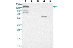 Western blot analysis of Lane 1: RT-4, Lane 2: U-251 MG, Lane 3: Human Plasma, Lane 4: Liver, Lane 5: Tonsil with CGN polyclonal antibody  at 1:250-1:500 dilution. (Cingulin anticorps)