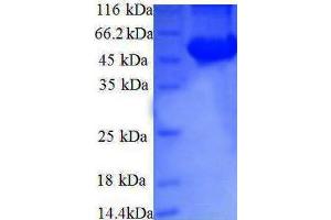 Ribosomal Protein S6 Kinase, 70kDa, Polypeptide 2 (RPS6KB2) (AA 1-210), (partial) protein (GST tag)