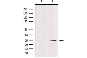 Western blot analysis of extracts from mouse brain, using C1QL4 Antibody. (C1QL4 anticorps  (Internal Region))