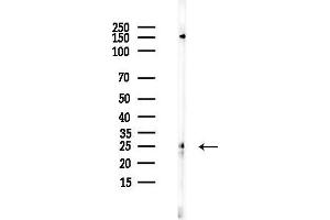 anti-Ras-Like Without CAAX 1 (RIT1) (C-Term) antibody
