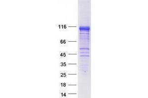 Validation with Western Blot