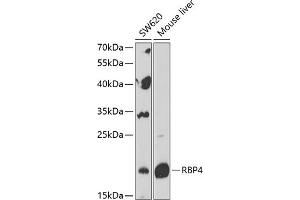 Western blot analysis of extracts of various cell lines, using RBP4 Antibody (ABIN6128555, ABIN6146803, ABIN6146804 and ABIN6216143) at 1:1000 dilution. (RBP4 anticorps  (AA 19-201))