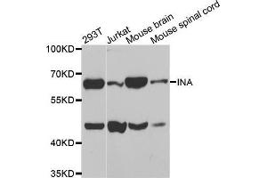 Western blot analysis of extracts of various cell lines, using INA antibody. (INA anticorps)