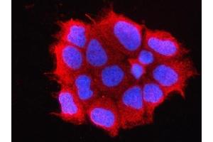 IF analysis of OMP using anti-OMP antibody (ABIN7601711).